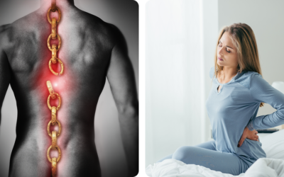 What are 3 Causes of Lower Back Pain?