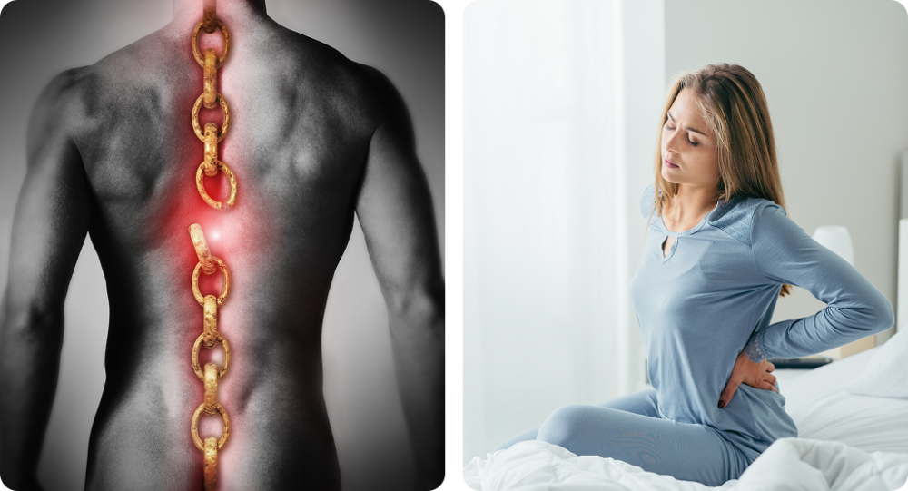 What are 3 Causes of Lower Back Pain?