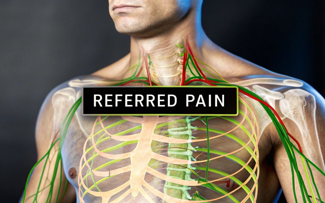 What Is a Referred Pain? Simple Explanation & Causes